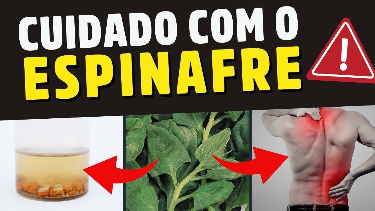 ⚠️ QUAIS OS PERIGOS DO ESPINAFRE E COMO CONSUMIR COM SEGURANÇA - Dr. Alain Dutra