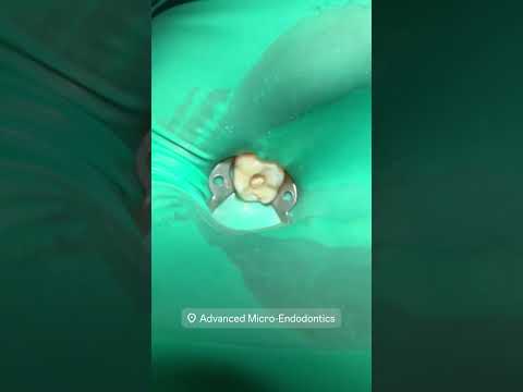 Next Dentists Dentalartistry Hygienist Rootcanaltherapy Dentalprocedure Apexdental 