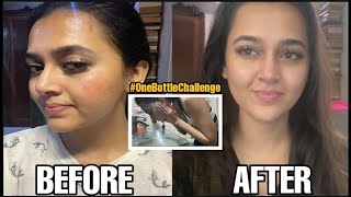 Acne & Oil Control With The #OneBottleChallenge | Does it work??