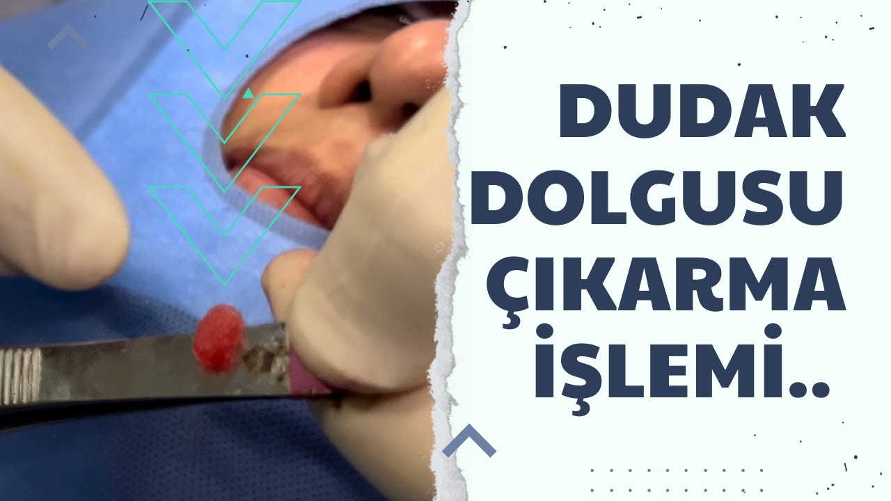 Kompyuterda erkakning onanizmini tomosha qiling