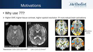 #190 Can resting state reflect urodynamic testing in delineating voiding networks using fMRI