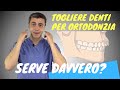 Serve DAVVERO togliere dei denti per migliorare il sorriso?