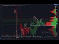 Breaking Bitcoin Market Update - Baseline Rejection and Fundamentals - Let's Prepare For the Week!