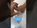 الم القدم او اصبع الرجل الكبير 
