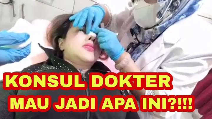 BEFORE AFTER OPERASI HIDUNG BARBIE KUMALASARI