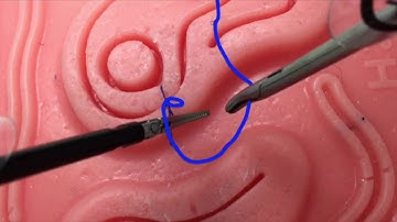 Knot Tying: Drop Needle Technique by @MIGS_TIPS