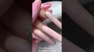 dont let this happen to your Nails, fill is every two or three weeks. fill nails badnails