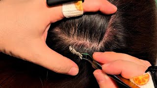 JOJO’s ASMR Scalp Care — Gentle Tweezer Accents \u0026 Steady Comb Motion | No Talking