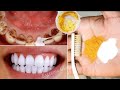 Secret That Dentists don