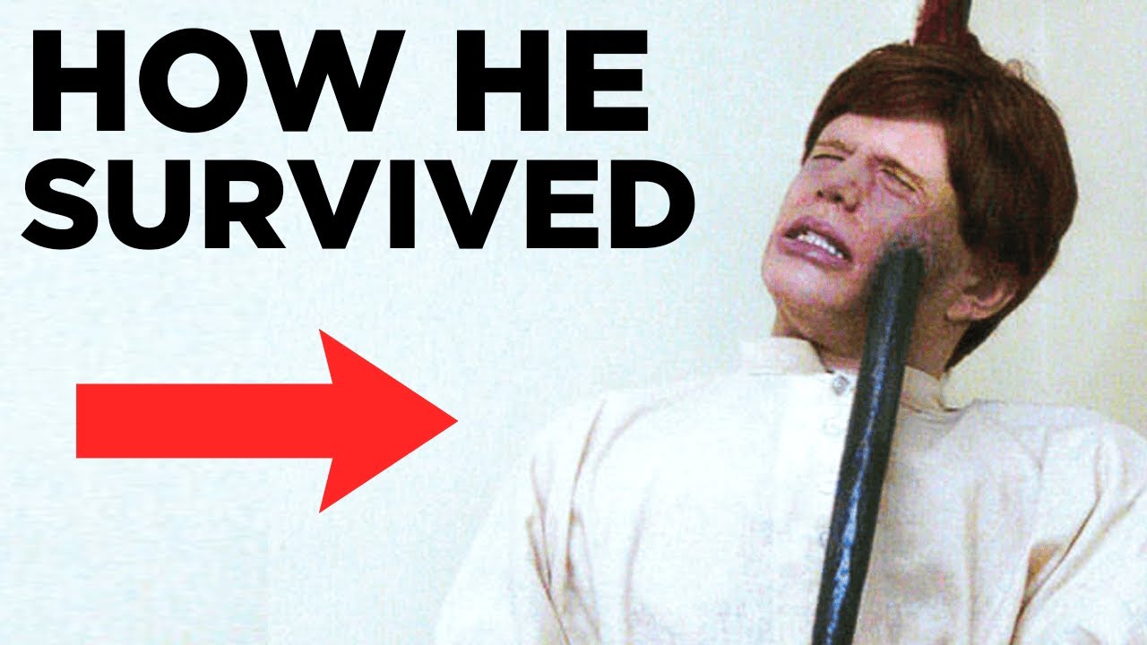 How This Man Survived A Steel Rod Piercing His Brain YouTube