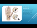 Basal Thumb Arthritis Explained by Dr Anzarut