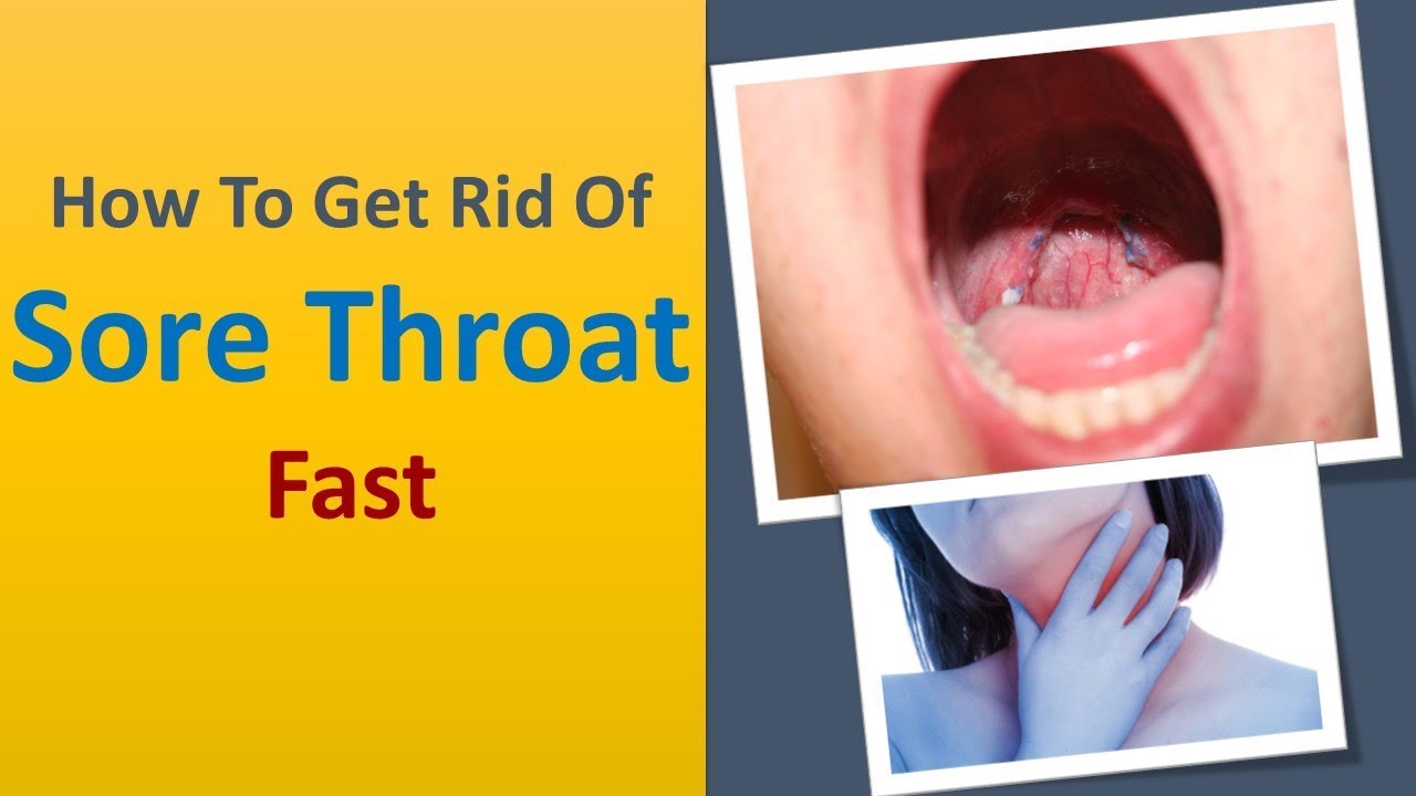 How To Get Rid Of Sore Throat Fast - Top 5 Tricks To Remove Sore Throat - YouTube