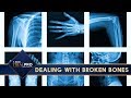 Orlando Broken Bone Injury Attorneys