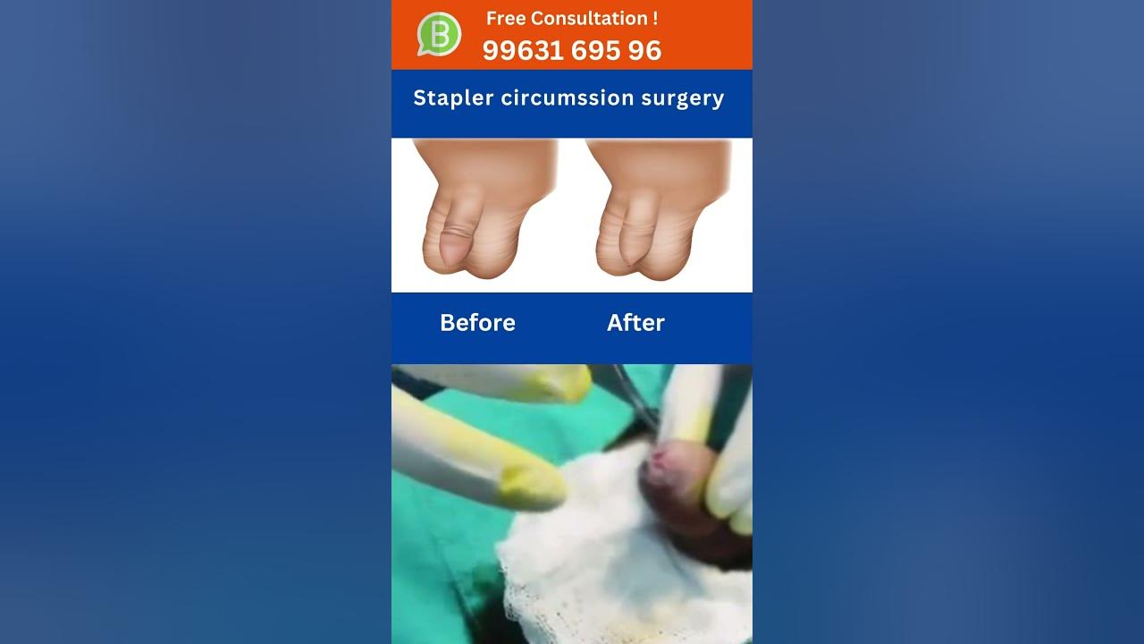 pain-circumcision-treatment-benefits-of-remain-forskin-sunti-operation