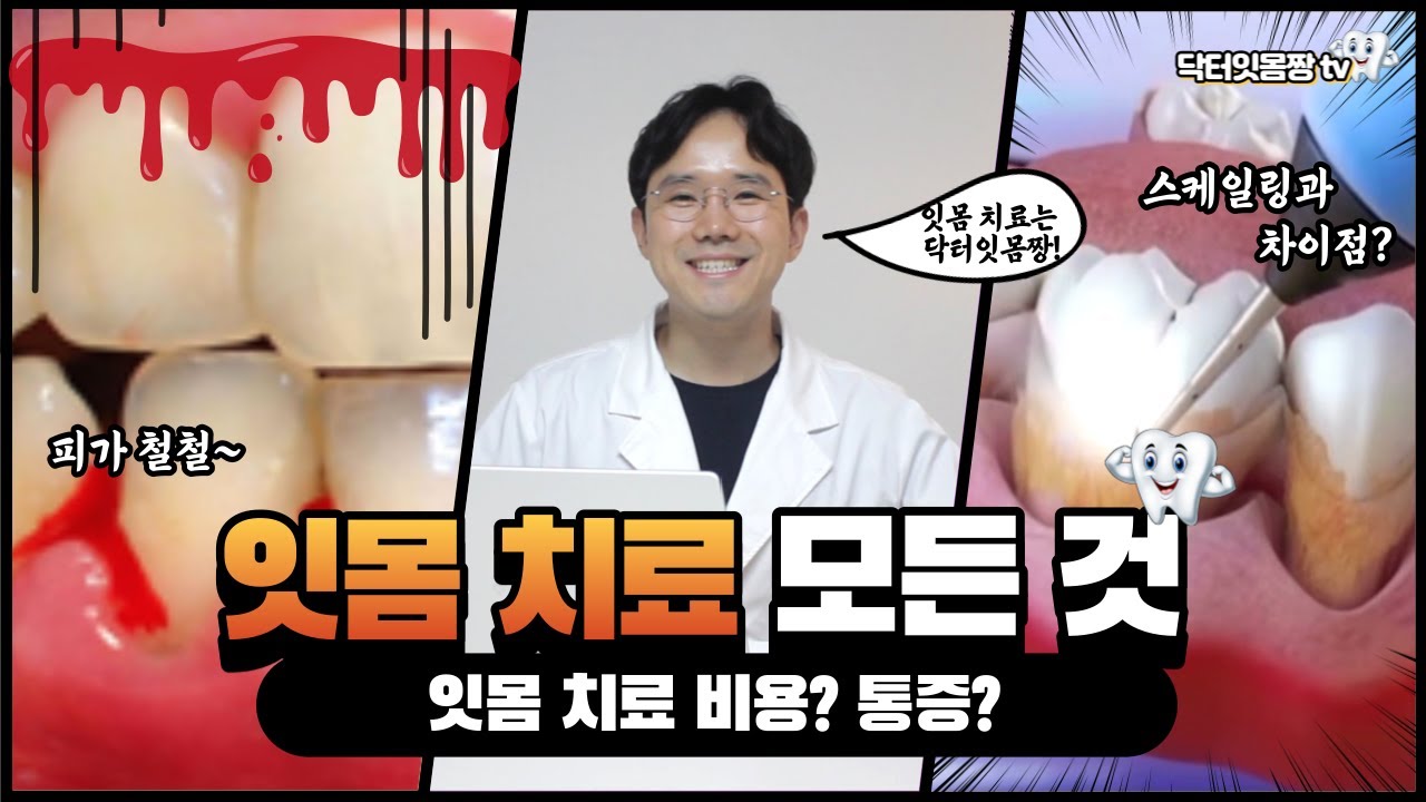 잇몸치료 비용? 통증? 과정? 👨‍⚕️ 잇몸치료를 전문적으로 하는 곳이 있다구요? 👍 잇몸치료의 모든 것 !!