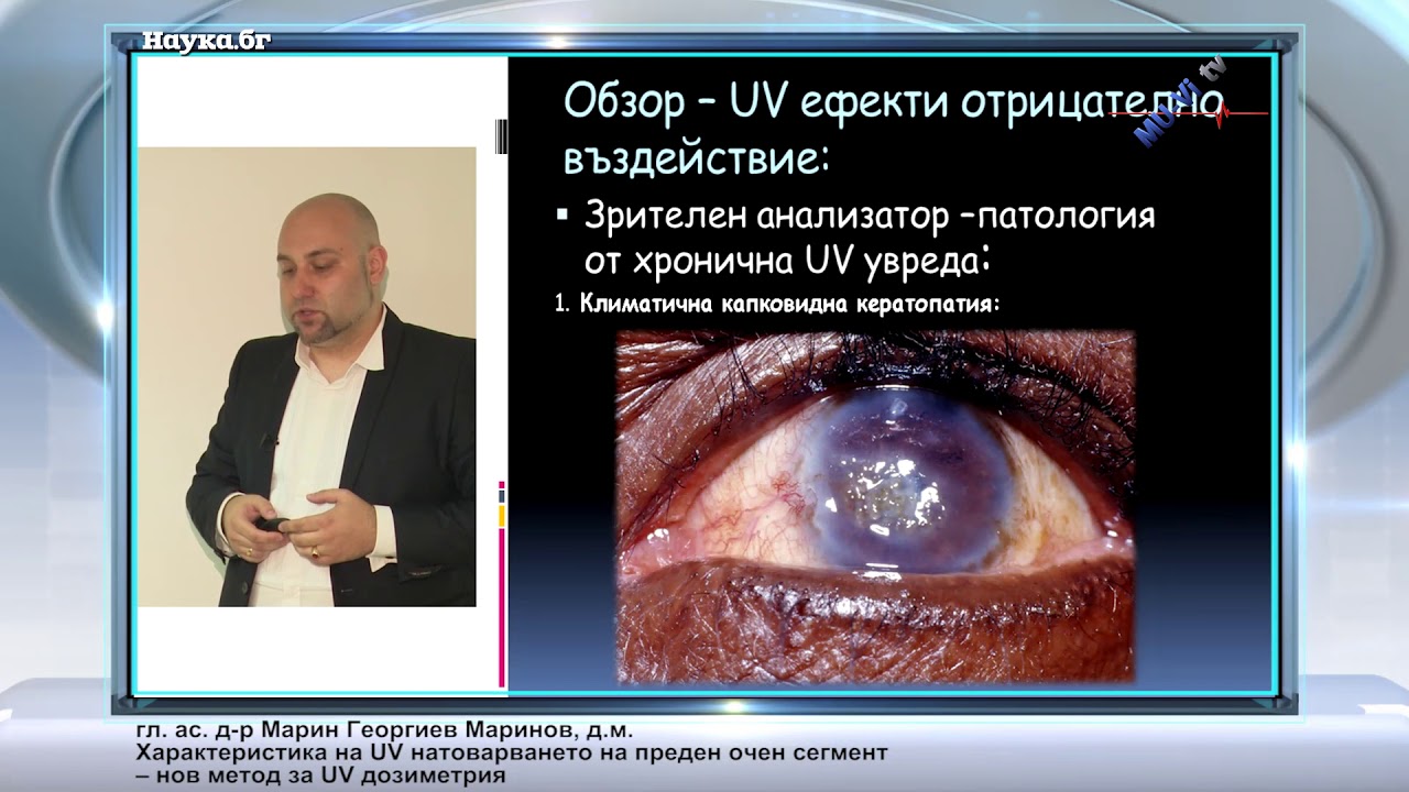 Характеристика на UV натоварването на преден очен сегмент - нов метод за UV дозиметрия
