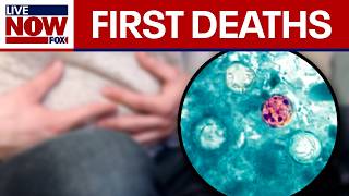 Deadly Cyclospora Outbreak: Michigan reports first deaths in U.S.