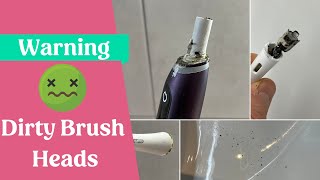 Mould in OralB brush heads