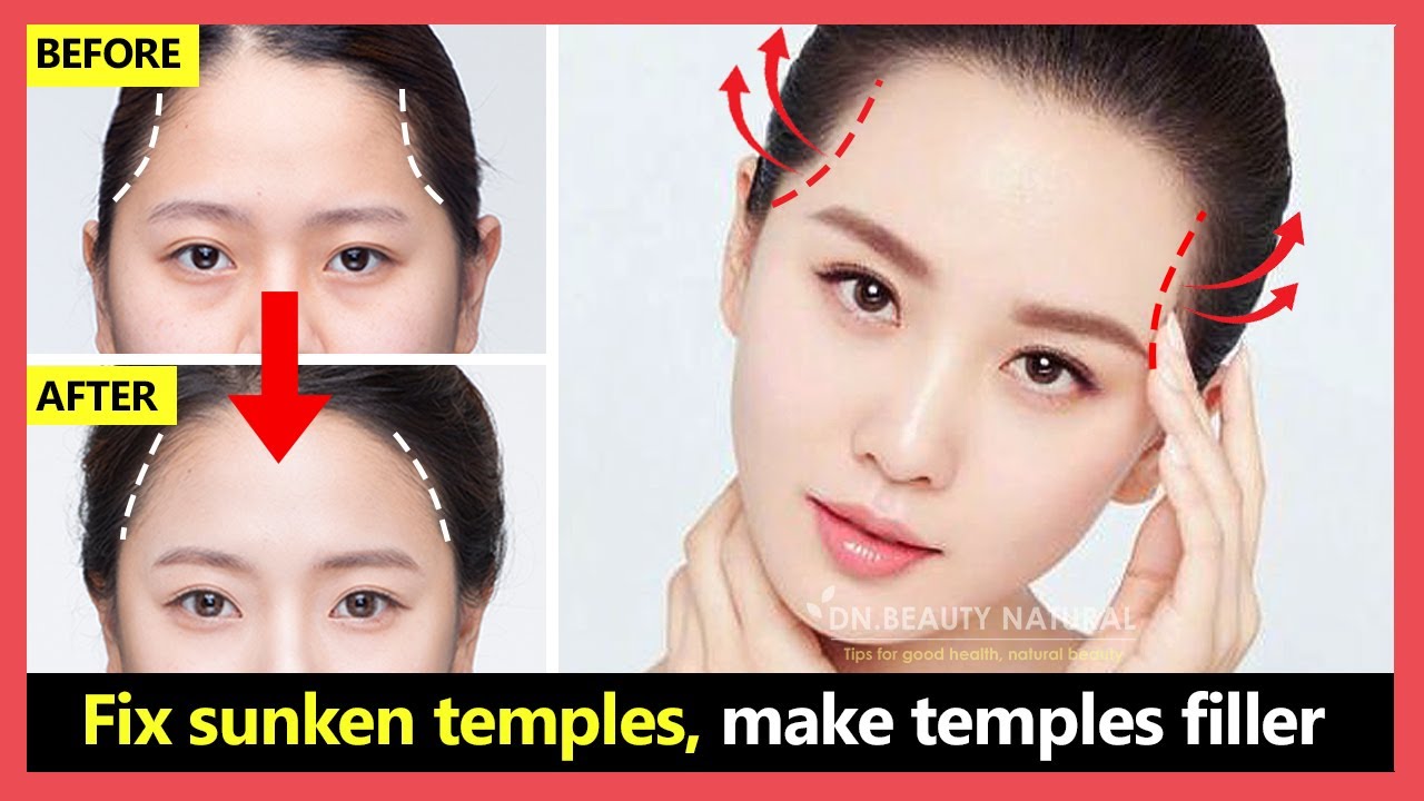 How To Fix Sunken Temples