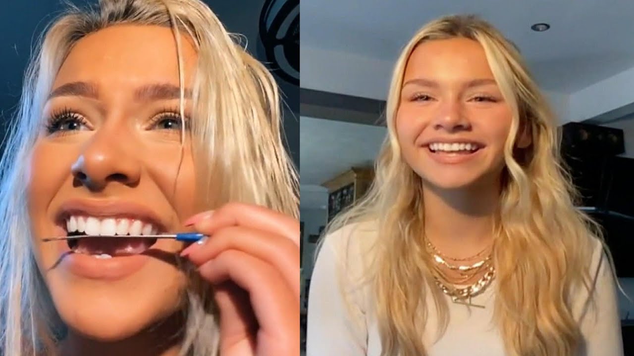 TikTok trend of whitening teeth with Mr. Clean Magic Eraser is not