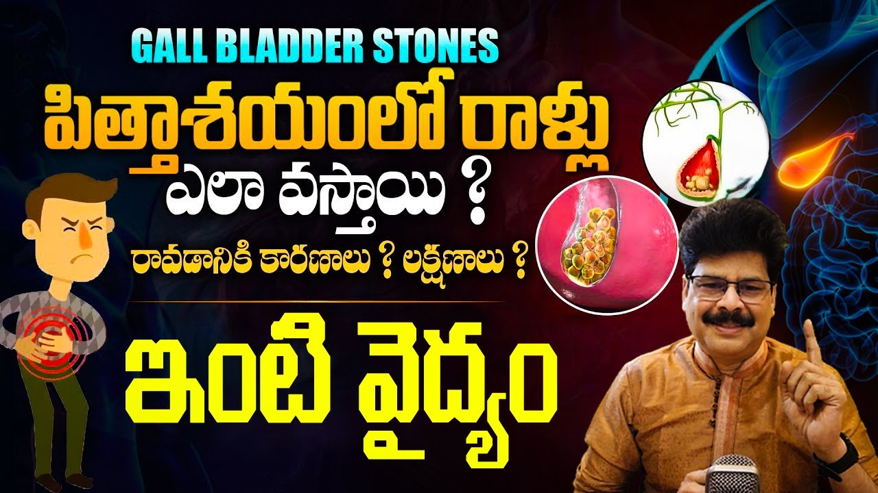 గాల్ బ్లాడర్‌‌లో రాళ్లు ఇట్టే కరిగిపోతాయి | How To Remove Gallbladder Stone without Operation