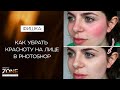 Как убрать красноту на лице в Photoshop. Убираем красные пятна с лица в фотошопе / Петр Михайлуца