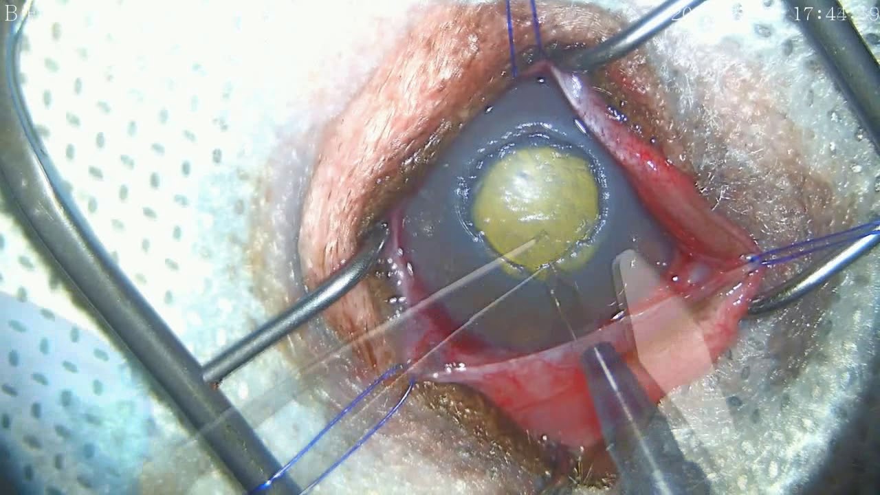 Истирание роговицы: лечение поцарапанной роговицы глаза
