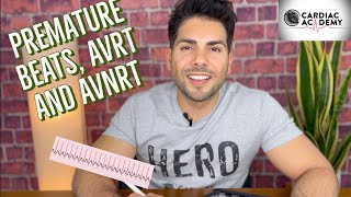 Premature Beats, AVRT and AVNRT