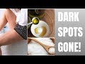They lied! How to REALLY remove dark spots on thighs | Victoria Victoria