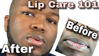 How To Get Smooth Soft Moisturized Lips - Lip Care 101 | Skincare Diaries screenshot 2