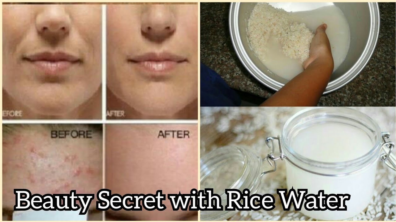 The Most Beautiful Skin With This Super Rice Water Toner That TONS Of VITAMIN - YouTube