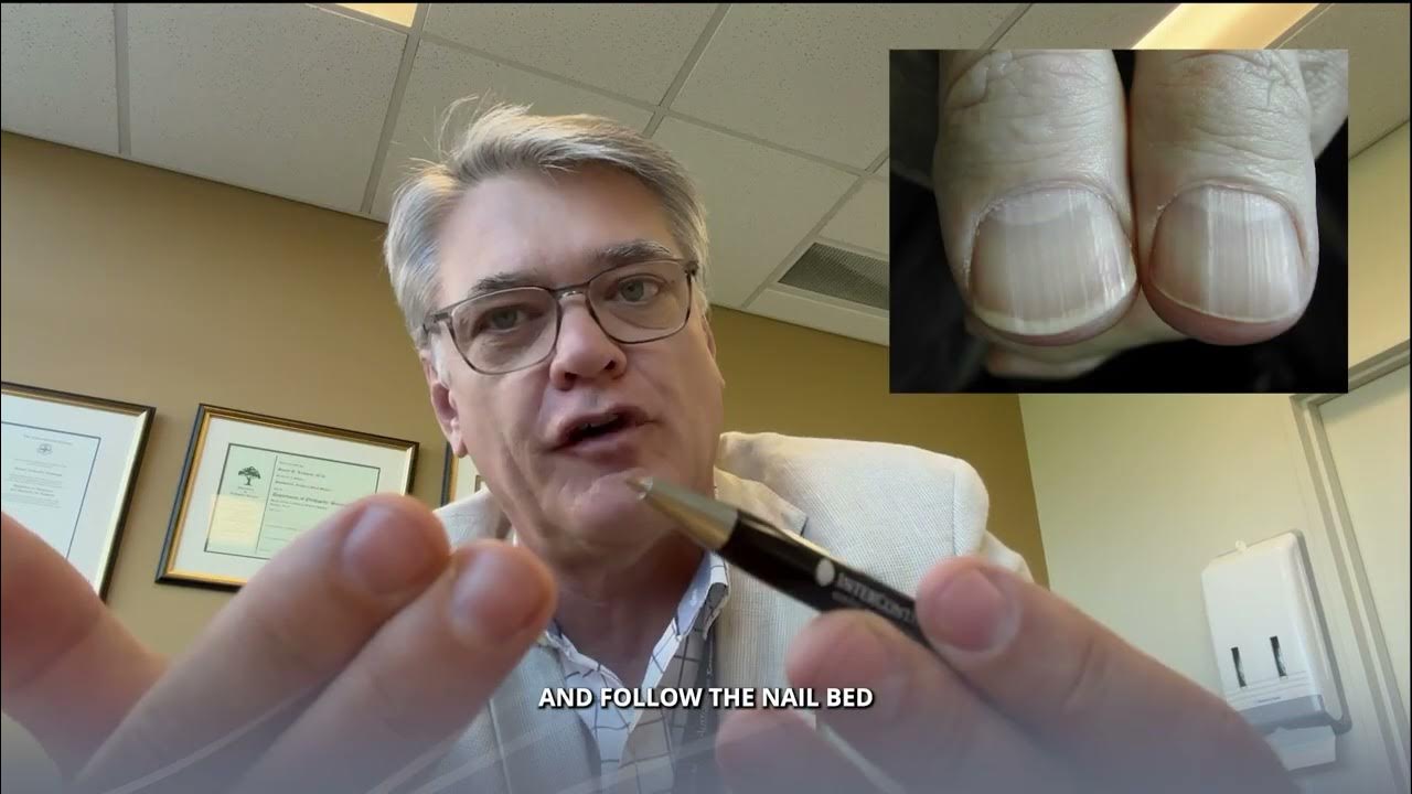 Restoring Damaged Nail Beds Accurate Steps for Recovery YouTube