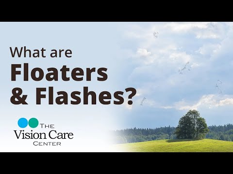 Dr. Miller answers the question, "What are Floaters and Flashes?"
