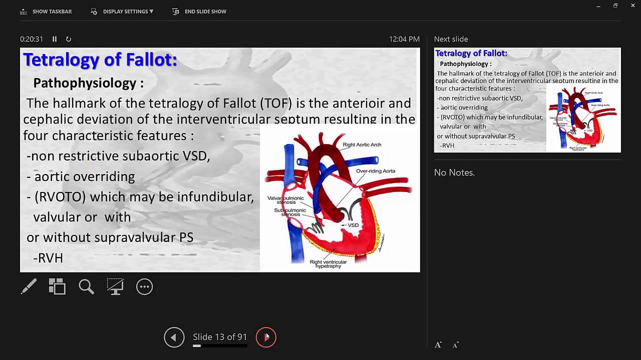 Congenital Caynotic Heart Disease (Dr.Amira)