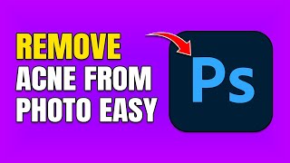 How To Remove Acne In Photoshop screenshot 5