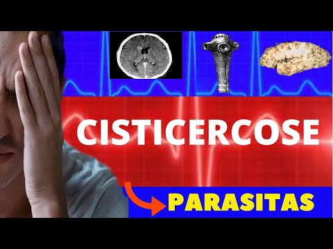 CISTICERCOSE - CICLO DE VIDA, SINTOMAS, DIAGNÓSTICO E TRATAMENTO - PARASITOLOGIA