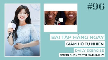 Bài 96 | Bài tập GIẢM HÔ tự nhiên | Fixing Buck Teeth Naturally