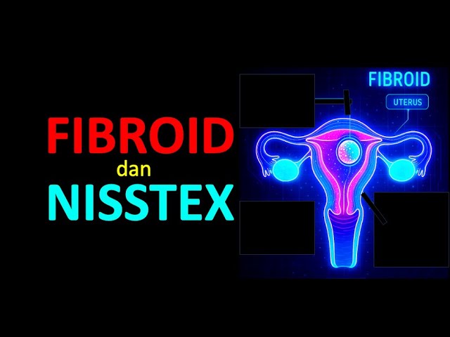 Nisstex dan Fibroid
