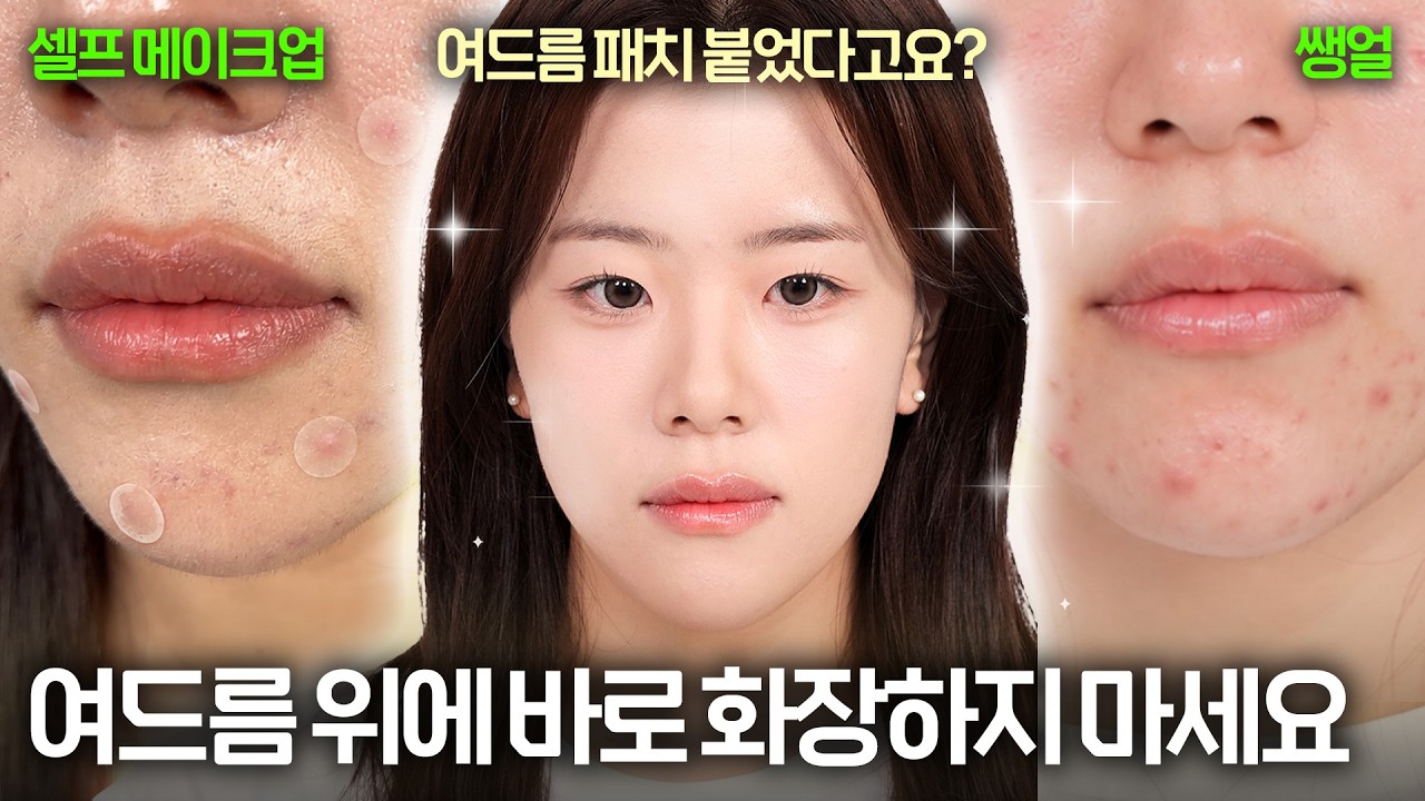 트러블 피부도 깔끔하게 커버 가능! 여드름 메이크업 제대로 하는 법