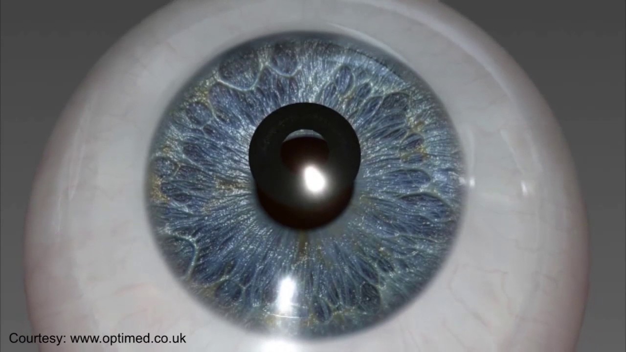 Dr. Michael Keil Seminar - KAMRA Inlay