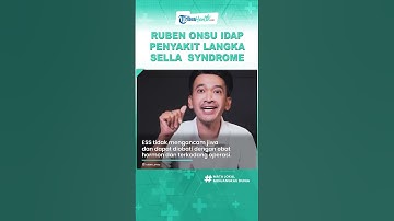 Ruben Onsu Idap Penyakit Langka Sella Syndrome, Buat Penglihatan Jadi Terganggu, Ini Penyebabnya