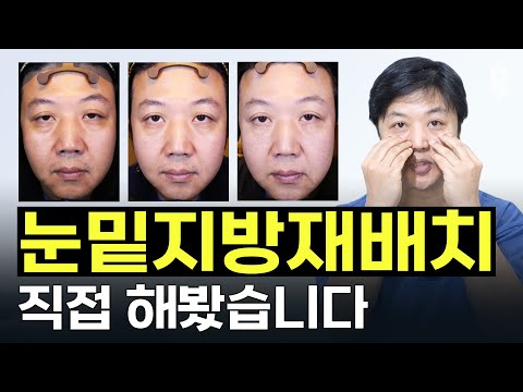 썸네일추출