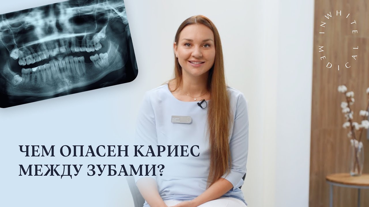 Кариес между зубами - что делать и как предотвратить?