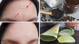 3 Effective Ways to Get Rid of Forehead Wrinkles at Home