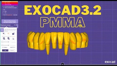 Exocad. 3.2 . Pmma Пластмасса. Easy making. thanks for watching