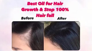 Hair fall prevent  at home Naturally | with only 2 Ingredients | simrankour_16