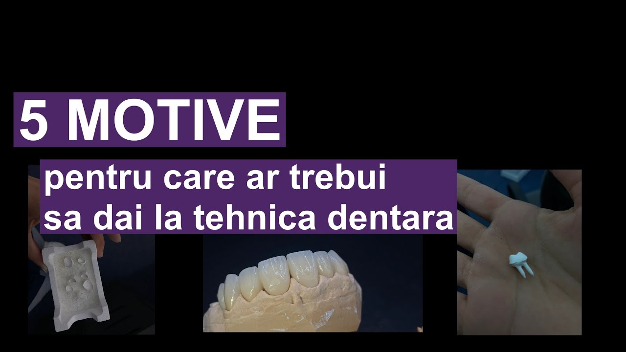 5 MOTIVE pentru care ar trebui sa dai la tehnica dentara