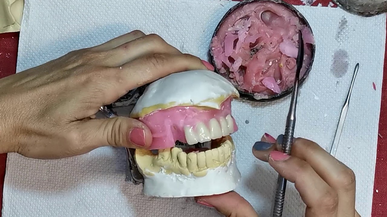 Prótesis Dental Total CLASE 3 Enfilado de dientes