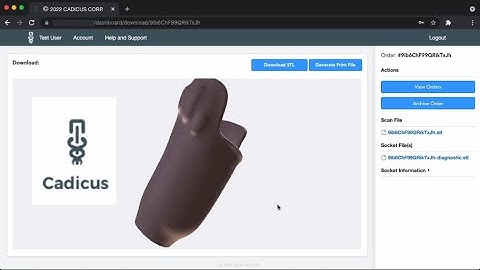How to create a 3D printable prosthetic socket using Cadicus