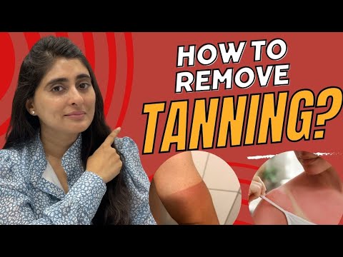 How to remove